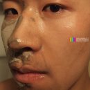 풍원게르마늄 이미지