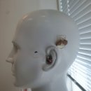 열린보청기 이미지