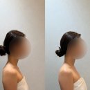 (주)미원 | 대구 피부관리 더에스테틱수미원 수분관리 후기