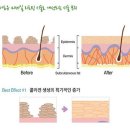 [닥터포유 홍대점 실리프팅]홍대실리프팅 동안성형, 실리프팅, V리프팅, 울트라V리프팅 잘하는 곳 닥터포유네트워크에서 전하는 'V리프팅' 이미지