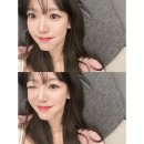 로즈성형외과의원 | 압구정피부과 "인모드 FX: 투턱 집중 +통증, 가격