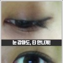아름다운사람성형외과의원 네이버블로그