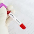 CDC는 경고 : 이제까지 미국에서 검출 된 조류 인플루엔자 A (H5N1) 바이러스 인간 감염의 첫 번째 케이스 이미지