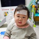 10개월 아기 A형 독감 증상 및 치료