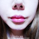 보앤필의원