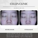 오라클성형외과의원 | 매탄권선역 피부과 전문 병원 추천 좋아요 6곳