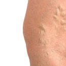 아름나무한의원 이미지