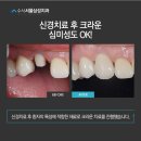 보일치과기공 네이버블로그