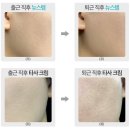 주식회사 스템랩 | 와디즈펀딩 / [평점4.8마지막앵콜]나노줄기세포배양액 뉴스템크림, 리페어보습 신의한수!