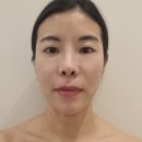 팀폴라리스 | 잠실새내 폴라리스 에스테틱 인퓨즈 웨이브 리프팅 관리 내돈내산 후기