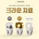 연세부부치과 네이버블로그