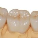 이프라임치과기공소 이미지