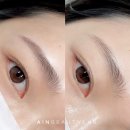 아인뷰티의원