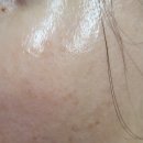 (주)디에스약품 | [내돈내산] 약국 꿀템 털어오기! 가성비 유산균 '메디락디에스' &amp; 전지현 기미크림(멜라토닝 크림)