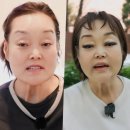 빅마마패션 | 71세 빅마마 이혜정 리프팅 시술 근황 1200만원 견적과 솔직한 후기