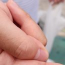 덱시안메드크림 사용 후기, 손습진 때문에 병원에서 찾게 된 보습크림