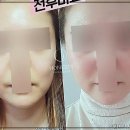 티포인트성형외과의원 | 신사역 성형외과에서 찾은 완벽한 코의 비밀: 아너스티성형외과 리얼 후기