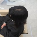 월드헤어살롱 | 파주 탈모 관리 탈모 고민 완벽하게 해결 헤어살롱수에서 헤어증모술 받은 후기