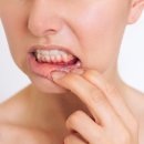 하얀수치과의원 네이버블로그