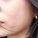 메타의원 | 청담 피부과 :: 줄기세포주사 자가 엑소좀 메타셀 효과 가격 후기