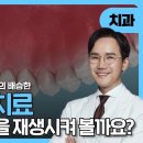연산동 닥터배치과 배승한 대표원장 흔들리는 치아 걱정이신 분 이미지