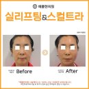 서울예쁨의원 이미지