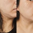 고려수지침 | 이중턱 잡아줄 홈케어 도도케어 EMS 브이라인 얼굴마사지기 사용후기