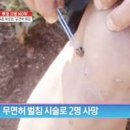 봉침 효능 벌침 주의할 점 이미지