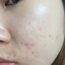 오투버블 | [버블버블🫧🫧 저자극 산소 미세버블 클렌저] 아이소브 오투 스노우 버블 액티베이터__후기