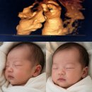 리틀덴마크 | [임신 28-29주] 열심히 논 일상, 분당제일여성병원 입체초음파, 철분주사, 역아돌리기