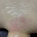 바른체형 의료기 이미지