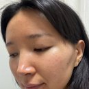 지성광고 | [NO광고X] 디페린겔0.1% 내돈내산 후기｜지성·모공 피부, 4주 사용 솔직 리뷰 | 나만의닥처 이용후기