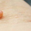 눈꽃피부과의원 이미지