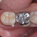 어썸치과기공소 이미지