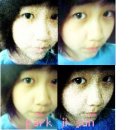 전중 Daum카페