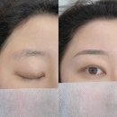 리메이드 - 김포시 김포대로 689 | 보정동눈썹문신 내돈내산 눈썹라인 교정 리메이드 후기