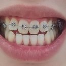 비에스치과의원 이미지