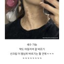 봉암중앙의원 네이버블로그
