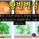 골감소증 치료 - 사암오행침, 사암침법, 오행침, 정통사암침 이미지