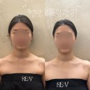 리브스킨케어 | 신부관리 n번째 받던 내가 정착한 천안 리브에스테틱 리온다 프로그램