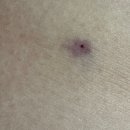 수정할매곰탕 | 시험관 동결 2차 실패 반착검사 + 자궁내막자극술 후기 5일배양 3차 이식