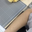 경산 효성의원 점공장 리터치 후기