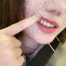 미라인치과의원 | 강남미라인치과 투스젬 후기! 😬✨ 가격, 부작용, 제거방법