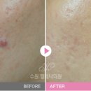헬레나의원 네이버블로그