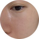 로지의원 | 이퀄로지 서클 아이앤립 크림 눈가 입가 주름 관리 후기