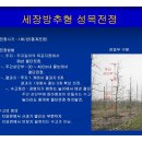 방추 이미지