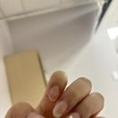 구례5일시장내 가단지(기물전) | 새해 액땜 급성 충수염 맹장 수술 후기 ;;