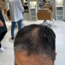영종정상어학원 | 영종도머리잘하는곳 박승철헤어스투디오에서 짧은 탈모머리 교정다운펌 했어요:)