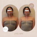 미담 스킨앤바디(美담 skin&body) | 팔이 무겁고 몸이 삐뚤어보이는 이유? [울산 옥동 은 에스테틱]