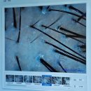 사랑한의원 원주점 | 원주두피관리 스케일링 탑스칼프 추천 #1